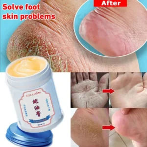 30g Moisturizing Anti-Drying Crack Foot Cream Hand Feet Care Family Exfoliation Dead Skin Removal Softening Smooth Skin Cream